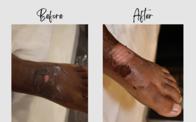 Ava’s Journey to Healing: A Testament to Compassionate Care