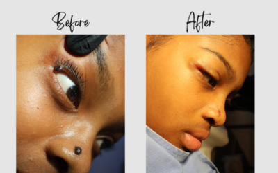 Shafiqua Sass: An Expedition of Hope with the Dr. Ansua Foundation.