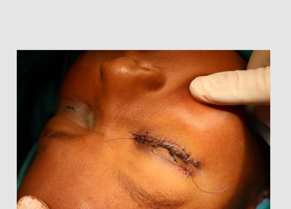 Hope for the Vulnerable: How Dr. Ansua Foundation Transformed Christiano's Life