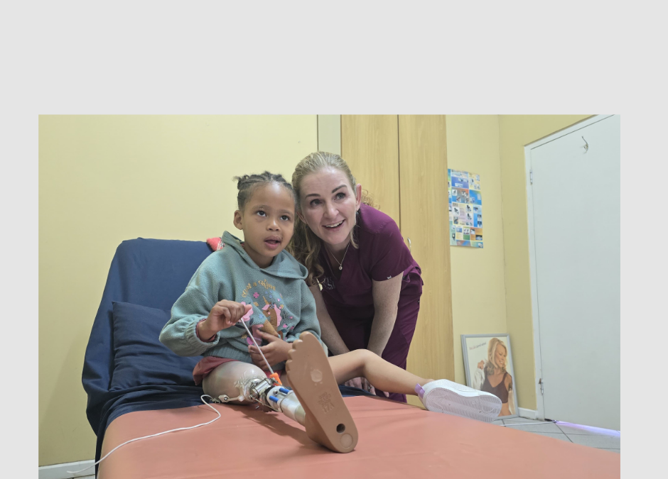 prosthetic leg transformation