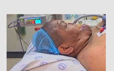 Stay Safe: 6 Essential Tips to Avoid Dog Bites